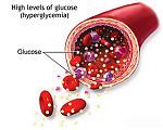 Hypoglycemia - High levels of glucose.
